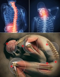 chronic-pain